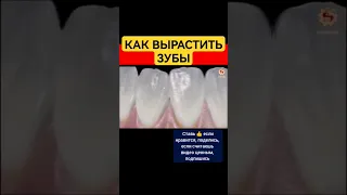 Как выращивать зубы правильно #тайноенепознанное #факты #зубыдоипосле #кариес