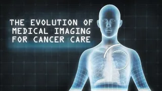 The Evolution of Medical Imaging for Cancer Care