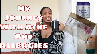 Skincare Journey - Oratane, Acne and Allergies