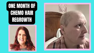 Hair growth after chemo | one month after chemotherapy | breast cancer stage 2a