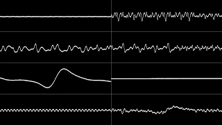 Sega Mega Drive - "Streets Of Rage 2" - Character Select (Yuzo Koshiro) Oscilloscope View