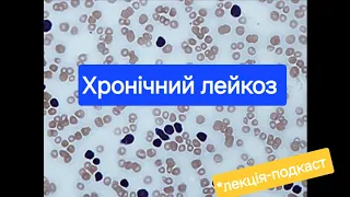 Лейкози: етіопатогенез, клініка, загальні аспекти діагностики.Хронічні лейкози. Лекція-подкаст