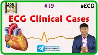 19. ECG Clinical cases