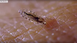 Presenter Gives Himself Head Lice On Purpose! | Earth Science