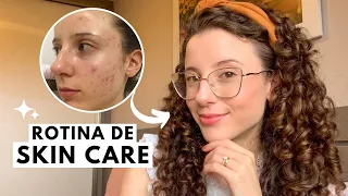 MINHA ROTINA DE SKIN CARE + PRODUTOS QUE EU USO ✨ Como venci as espinhas