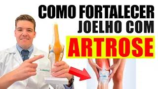 ARTROSE DE JOELHO - Como fortalecer?