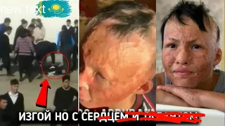 МАЛЬЧИК ИЗ КАЗАХСТАНА БОЯЛСЯ ЛЮДЕЙ НО В ОДИН ДЕНЬ ОН ШОКИРОВАЛ ВЕСЬ МИР!!!!!