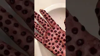 Do they scare you? #trypophobia #phobia