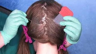 ASMR Scalp Check with Bad Results (Lice Check, Dandruff Removal, Scalp Treatment) Medical Roleplay