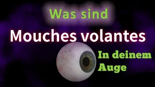 Mouches volantes. Richtige Sprechweise, Bedeutung. Korrekte Aussprache. Gutes Deutsch. Fleck im Auge