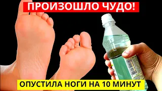 Ванночка с уксусом через 3 дня вытянула из организма такое! Просто опускаешь ноги и …