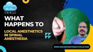 What happens to Local anesthetic drug in Spinal Anesthesia? #anesthesiaTOOLS