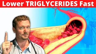 Lower TRIGLYCERIDES Quickly (Simple Steps) 2024