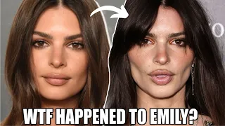 omg, WTF has Emily Ratajkowski done to her face?!