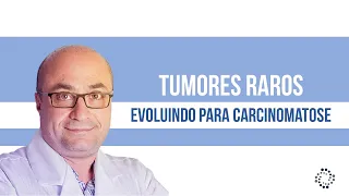 Tumores raros que evoluem para carcinomatose | Dr. Arnaldo Urbano