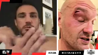 'IT WASN'T AN ELBOW' - THE MAN WHO CUT TYSON FURY (AGRON SMAKICI) REVEALS ALL ON SPAR, CUT & OPETAIA