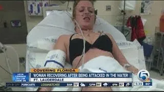 22-Year-Old woman suffers shark bite off Ft. Lauderdale