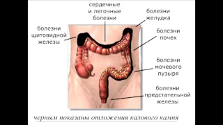 АМПЛИФИР ИЛИ ПОЧЕМУ НУЖНО ЧИСТИТЬ КИШЕЧНИК