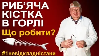 Риб'яча кістка застрягла в горлі. Що робити - як правильно дістати кістку з горла ?