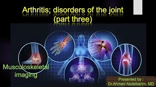 18 Arthritis part three