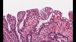 LG02 Esophagus Pathology Slide Review 17 min