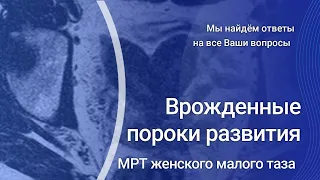 Врожденные пороки развития