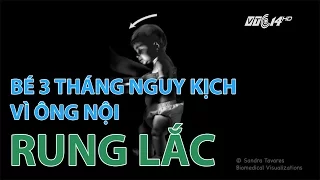 (VTC14)_Bé 3 tháng nguy kịch vì ông nội rung lắc để dỗ dành