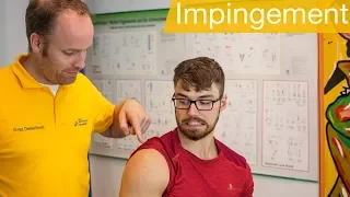 Impingement Syndrom Schulter ⚡️Übungen | Ursachen | Test | Behandlung