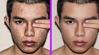 Fastest way to clean your face in photoshop | Remove pimples, blemishes, acne easily