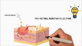 Proretinal nanoparticles – Video abstract 111748