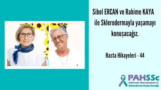 Hasta Hikayeleri - Rahime KAYA ve Sibel ERCAN ile Sklerodermayla Yaşamak - 44