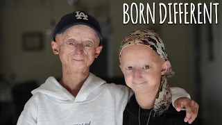 The People Who Age Too Fast | BORN DIFFERENT