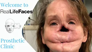 Welcome to Real Life Faces Prosthetic Clinic