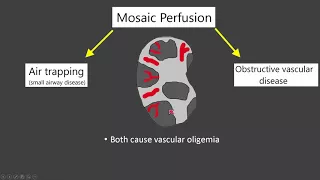 Mosaic Attenuation