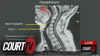 Respiratory Expert says George Floyd Died of "Low Level of Oxygen" | COURT TV