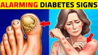 8 Alarming Signs You Have Diabetes!