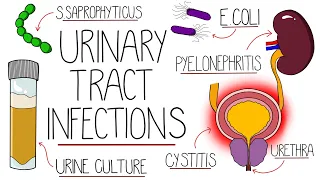 UTI Made Easy - Urinary Tract Infections Explained Clearly
