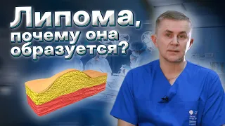 Что такое липома, почему она образуется?