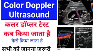 Colour Doppler ultrasound कब किया जाता है - और कैसे होता है