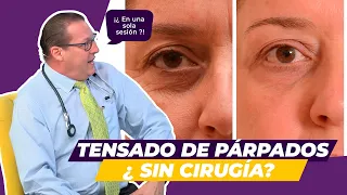 Tensado y levantamiento de párpados sin cirugía - Rejuvenecimiento láser sin cortes