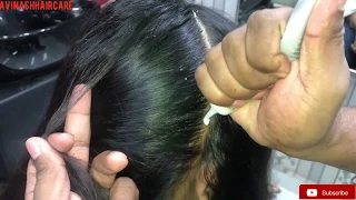 How to Do Dandruff treatment In Hindi/ matrix/ Dandruff Hair spa/at Home/ step by step/Tutorial 2020