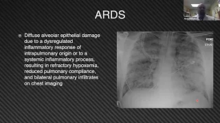 Pros vs Cons for using paralytics in ARDS