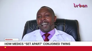 How medics set apart conjoined twins