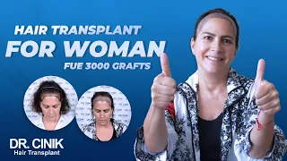 Dr.Cinik Hair Transplant For Woman | FUE |  3000 Grafts