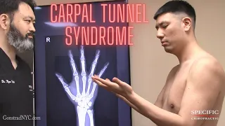 AVOID SURGERY for Carpal Tunnel Syndrome - Specific Chiropractic NYC