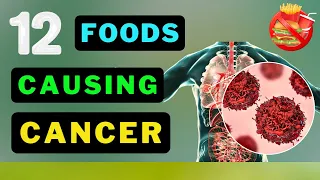 Cancer on the Menu? Top 12 Foods You Should Rethink Eating