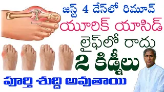 Uric Acid || జస్ట్ 4 డేస్ లో రిమూవ్ యూరిక్ యాసిడ్ లైఫ్ లో రాదు || Dr Manthena Satyanarayana Raju