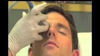 How to Case Study  Ocular Ultrasound Part 1   SonoSite, Inc