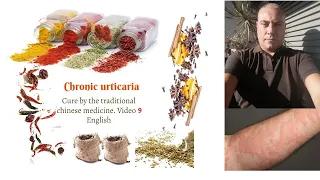 Cholinergic urticaria cure, Dampness and Phlegm in urticaria. Video 9 English.