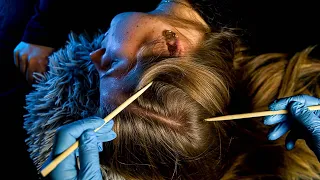 Ultimate ASMR Scalp Inspection on a REAL Person (No Talking)